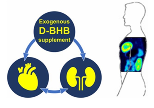 Ketone salts are taken up by the heart and kidneys