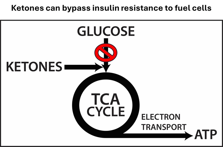 ketones bypass insulin resistance to make ATP